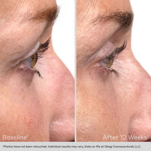 93% of participants reported an improvement in the appearance of their eyelashes