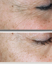 Before and After - SkinMedica TNS Recovery Complex 1.0 oz.