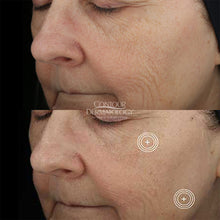 SkinMedica Advanced+ Serum, before and after photo.